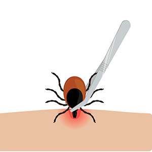 Get the tweezers as close to the head of the tick as possible.